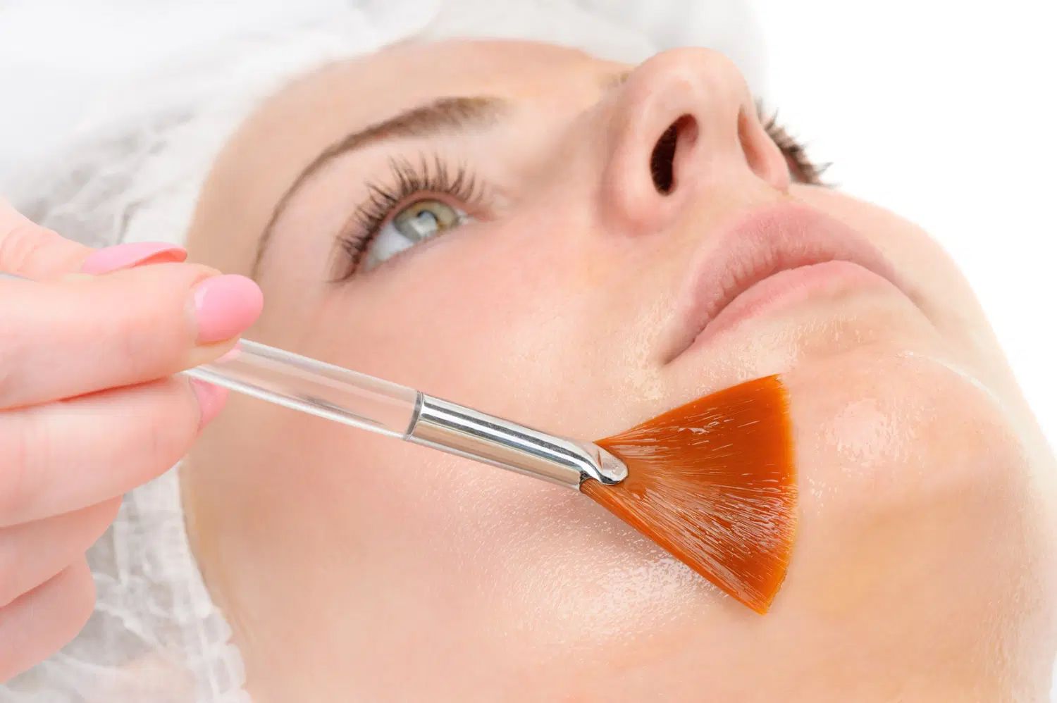 Chemical peel treatment being applied to a patient's face by a skincare professional